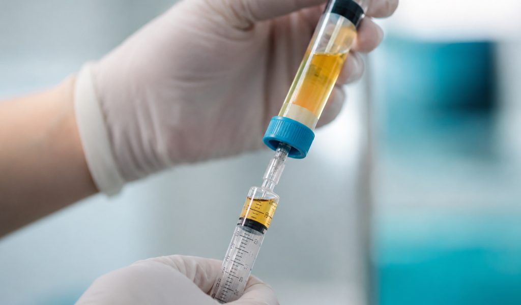 Medical hands handling syringe and test tube